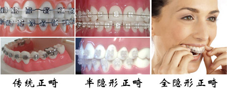 8-150G4164441441.jpg