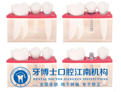 QQ截图20170915111531.jpg