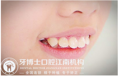 QQ截图20170923145412.jpg