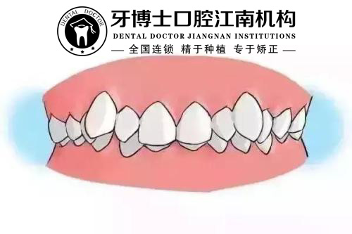 u=3219930117,3925274038&fm=27&gp=0.jpg