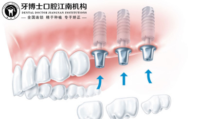江南牙缺失.jpg