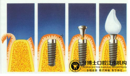 江南种植58.jpg