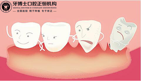 正恒 牙周炎4.jpg