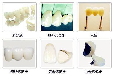 不同材质烤瓷牙对比图