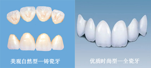 全瓷牙