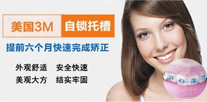 自锁托槽矫正