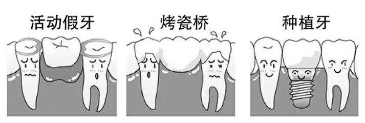 镶牙