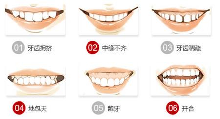 牙齿畸形