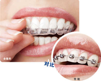  牙齿畸形