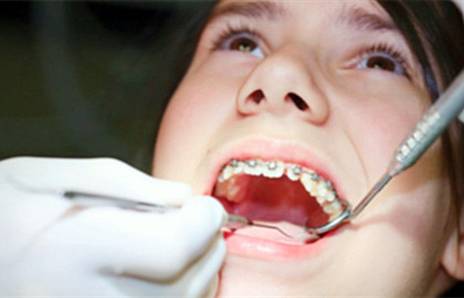 儿童牙齿畸形几岁矫正好