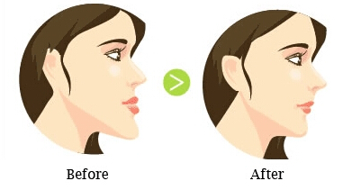 常熟地包天会影响说话时的发音吗