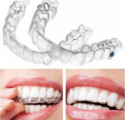 深圳隐形牙齿矫正多少钱