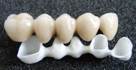 吴江做完美牙冠该怎么正确护理