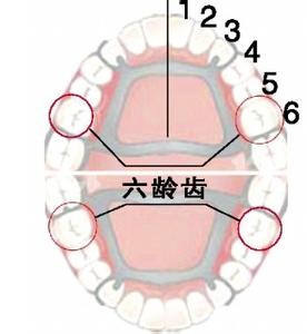 窝沟封闭的牙齿