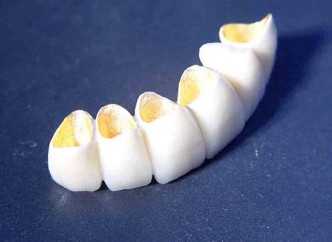 昆山怎么辨别烤瓷牙做的好不好