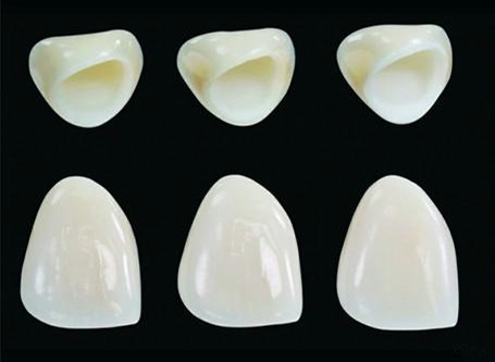 江阴牙齿缺损镶烤瓷牙效果如何