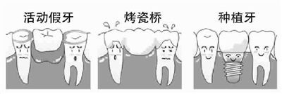 种植牙技术与其它两项技术的对比