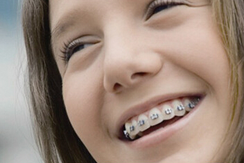 儿童牙齿畸形怎么办