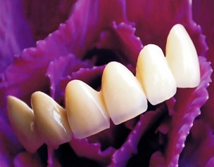  纯韩仿生美牙冠技术解读