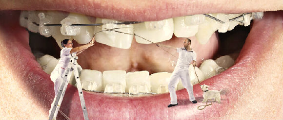 牙齿畸形矫正治疗