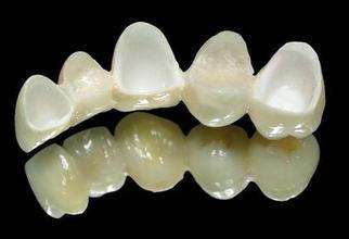 深圳全瓷牙价格多少？