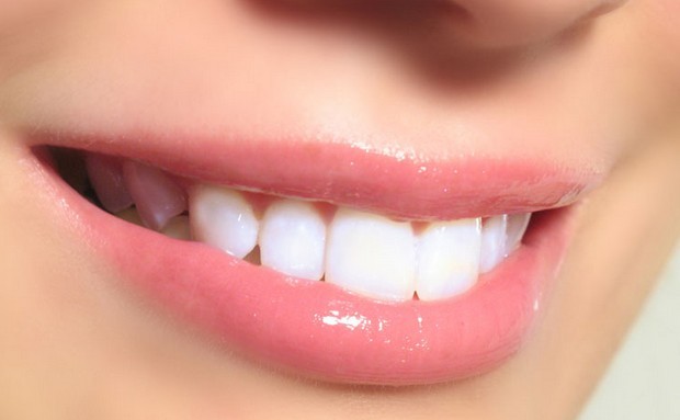 深圳罗湖牙齿矫正哪家比较好