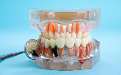 误区解读：做过牙齿矫正老了容易早早掉牙吗