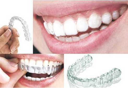 男性、女性牙齿矫正分别什么年龄比较适合