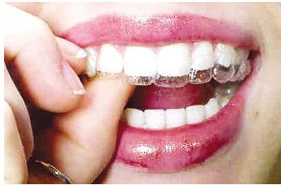 深圳隐形矫正的费用大概是多少