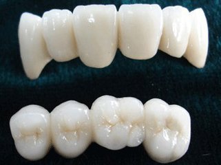 什么情况下可以使用美容冠