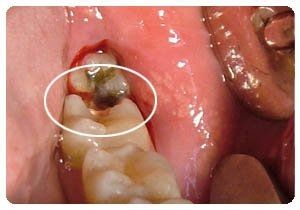 1520822493988655.jpg timg.jpg